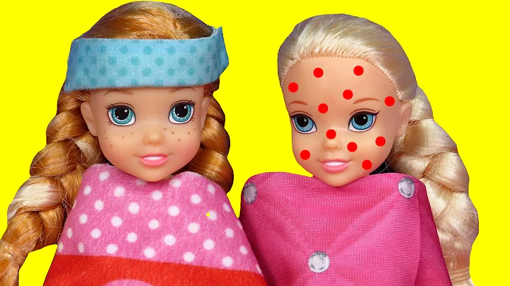 Toddler is SICK ! Elsa & Anna - CHICKENPOX - The o...