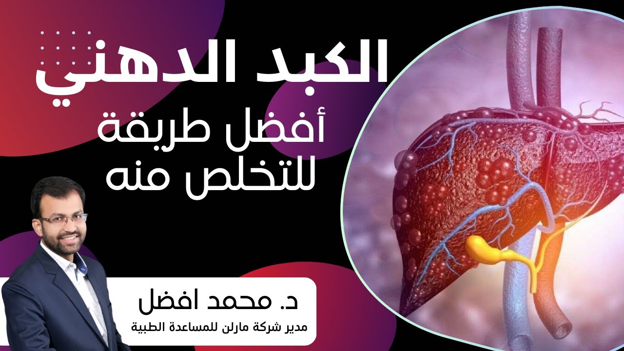 الكبد الدهني | أعراض تخبركم بوجود دهون في الكبد | وما هي أفضل طريقة للتخلص منها
