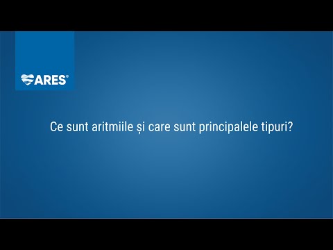 Ce sunt aritmiile și care sunt principalele tipuri | Doctor  Horia Roșianu | ARES |