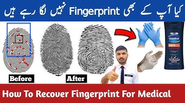 biometric fingerprint problem || qvc Medical ||