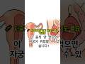 여성 필수! 자궁경부암 예방하는 음식 5가지 공개! #쇼츠 #자궁암 #예방 #여성 #음식 #건강정보