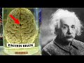 How Einstein&#39;s Brain was Different ?