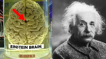 What is in Einstein brain?