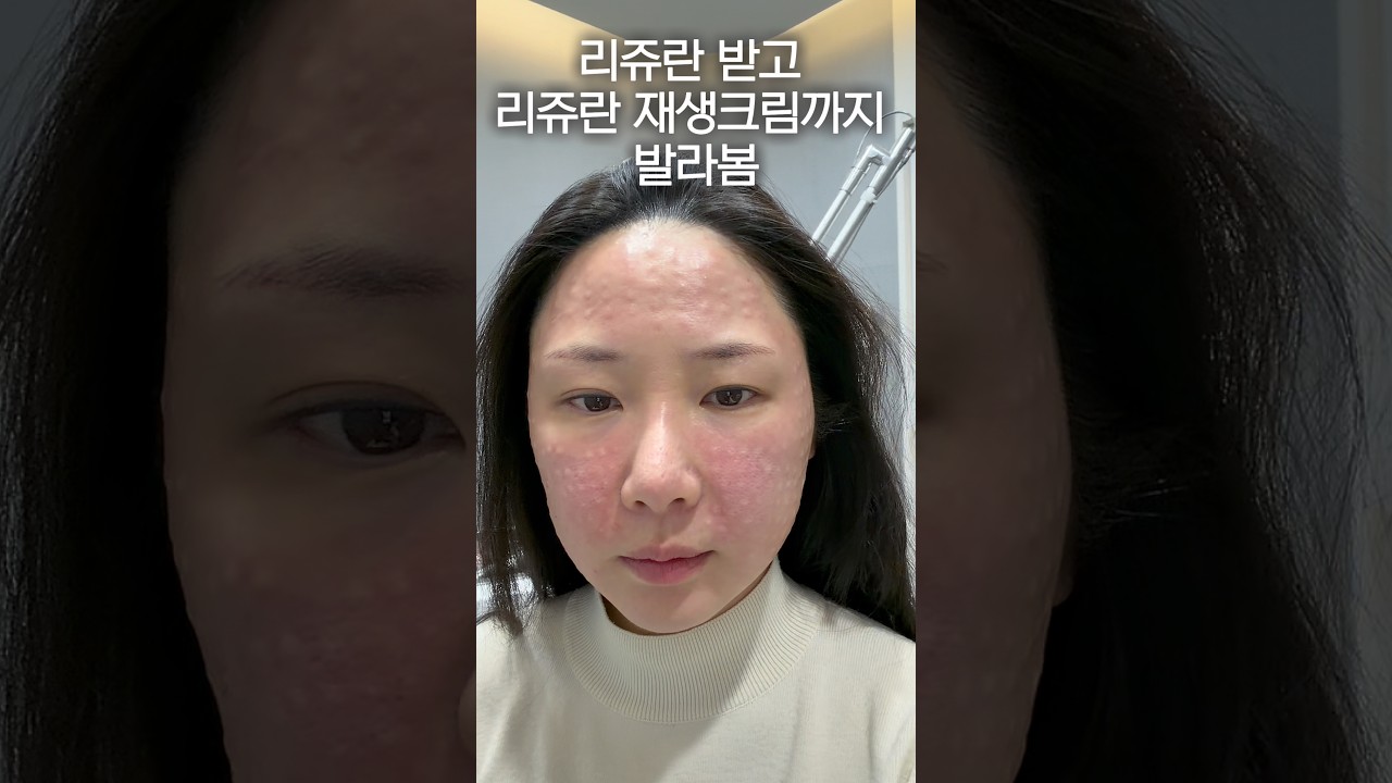리쥬란 효과 배로 올리는 방법
