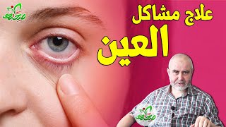 وصفات لعلاج أمراض العيون / الجفاف - احمرار - الحكة مع الدكتور كريم عابد العلوي