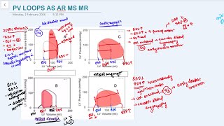 PV loops atrial stenosis atrial regurgitation mitral stenosis mitral regurgitation Physiology 