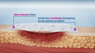 Cutimed® Sorbion® Border [German]