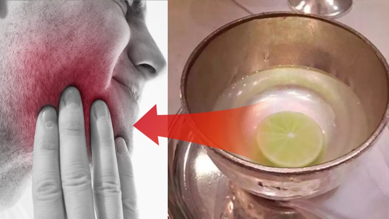 2 मिनट में दांत दर्द खत्म हो जाएगा, दांत दर्द का इलाज !! Tooth pain treatment - YouTube