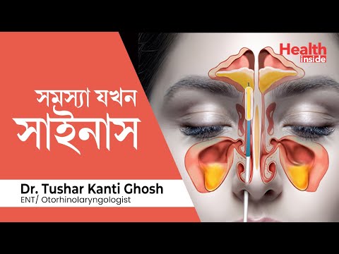 ভিডিও: সিনুস মানে কি?