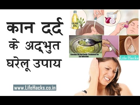 कान के दर्द के घरेलू उपचार – Home Remedies for Earache | Must Watch