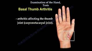 Examination Of The Hand, Tests for examination of the hand, carpal tunnel syndrome..