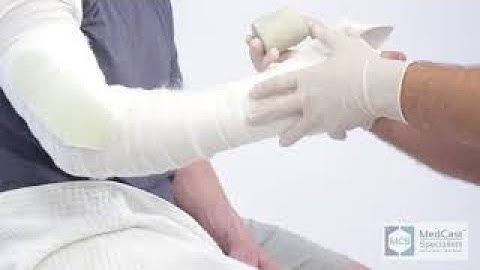 How to apply a MUENSTER CAST - Plus Cast Removal