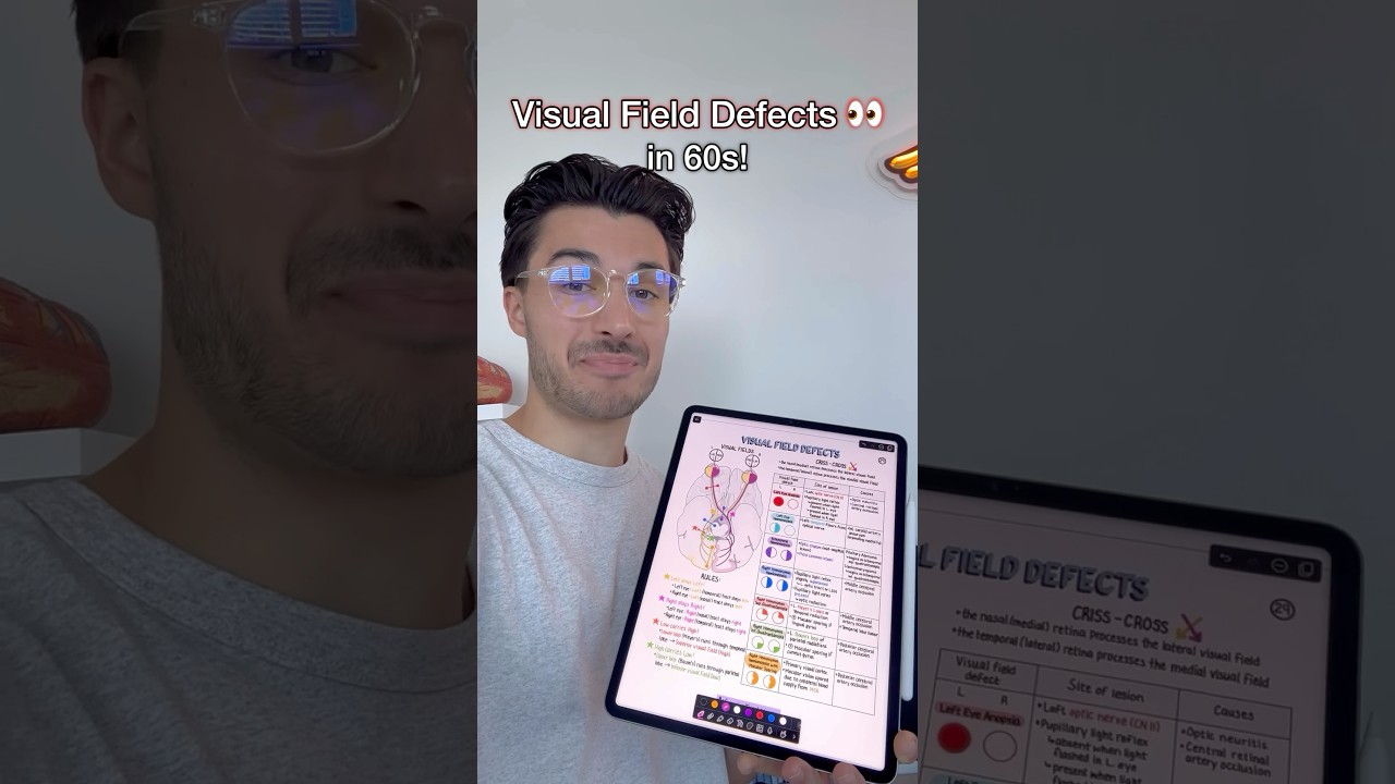 Простой способ исправить дефекты поля зрения 👀❌ 