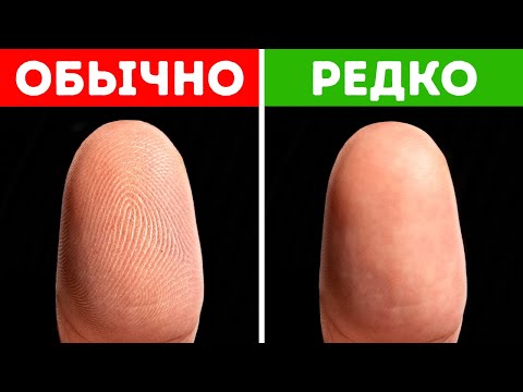 Как живут и путешествуют люди без отпечатков пальцев