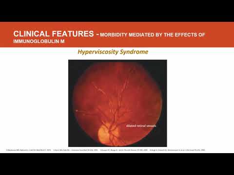 Vídeo: O Ibrutinibe, Um Inibidor Da Tirosina Quinase De Bruton, Exibe Atividade Antitumoral E Induz Autofagia No Glioblastoma