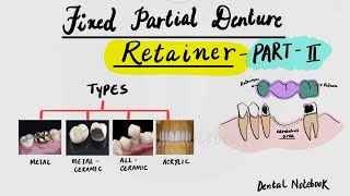 Fixed Partial Denture [ Retainer] part -2  [ classification ... continued.. ]