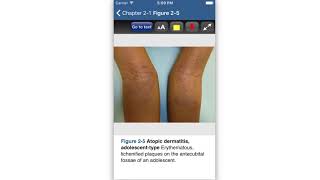 The app for Color Atlas & Synopsis Of Pediatric Dermatology, 3/E is now available for mobile devices screenshot 2