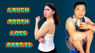 Laugh tooth loss part 11