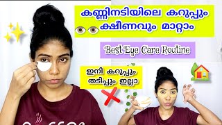 ?Dark Circles വളരെ എളുപ്പത്തിൽ മാറ്റാം| How to remove Dark Circles easily at home