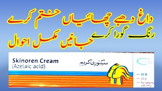 Skinoren Cream | Azelaic Acid |a- Uses, Benefits & Side Effects For Skin Treatment and Acne Issues Skinoren Cream | Azelaic Acid |a- Uses, Benefits & Side Effects For Skin Treatment and Acne Issues