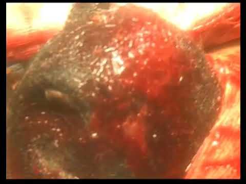 Vídeo: Estasi GI En Conills - Síndrome De Bola De Cabell En Conills - Bloqueig Intestinal En Conills