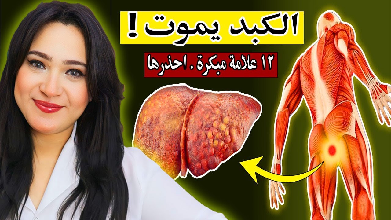 أحذر.. 12 علامة غريبة تدل على تلف وموت الكبد | أقوى طعام لعكس تلف الكبد وازالة السموم والندبات منه