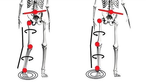 PAILS/RAILS Internal Rotation of Tibia