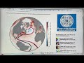 Cold Blob is the Canary in the Mine for AMOC Ocean Current Collapse to Shutdown: New Science Update