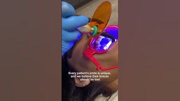 3D Placed Braces | Orthodontist for Teens and Adults | Irvine, CA