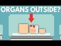 What Happens When Organs Grow Outside Your Body?