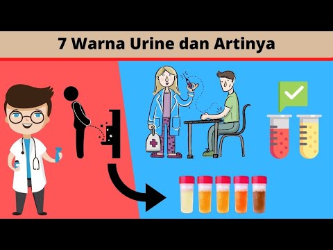 Video: Apakah warna ais: adakah setiap warna boleh dipercayai?