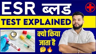 Esr Blood Test In Hindi Gyanear