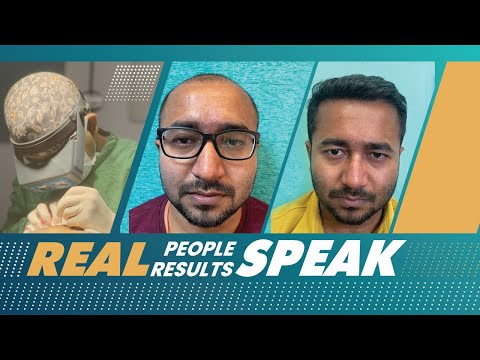 Why Choosing the Right Surgeon Matters for a Hair Transplant? - video