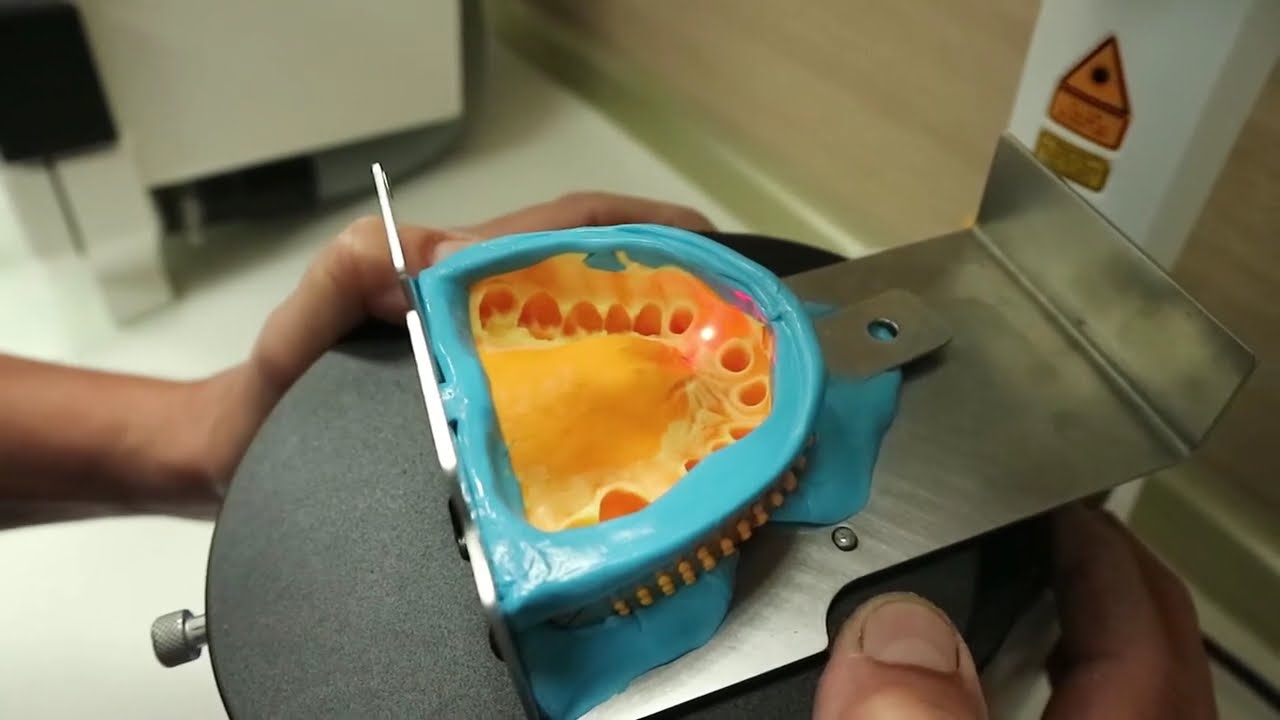 Fast dental model production with HIGH PRECISION | Giuseppe Doti´s workflow with AUTO spin