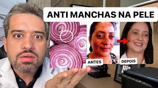 Pele com Manchas? Descubra o Melhor Clareador de Manchas na sua Cozinha - Receita Mágica