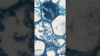 Tilia Stem Under The Microscope 40X - 1000X