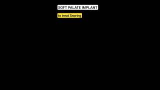 Soft palate implant to treat snoring? #shorts screenshot 5