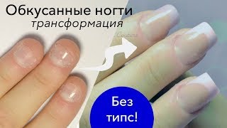 Наращивание на Короткие Обкусанные Ногти