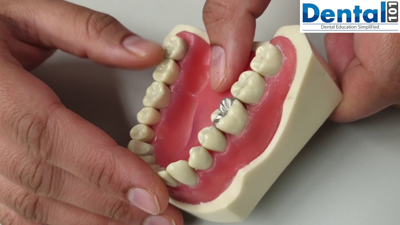 How to self assess: Amalgam task?