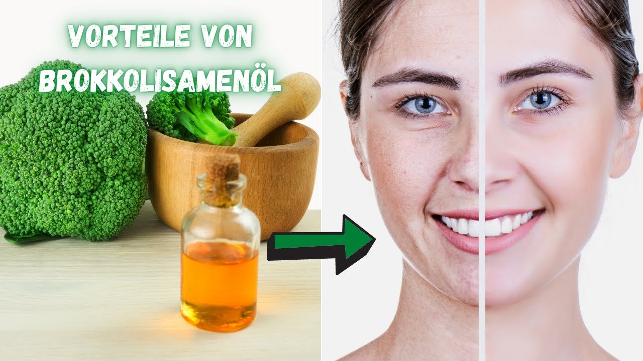 6 Vorteile von Brokkolisamenöl
