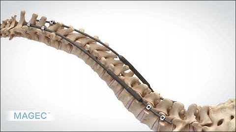 MAGEC™ - Procedural Animation