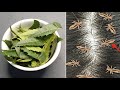 In Half An Hour Home Remedy To Get Rid Of Head Lice And Nits In Half An Hour Home Remedy To Get Rid Of Head Lice And Nits