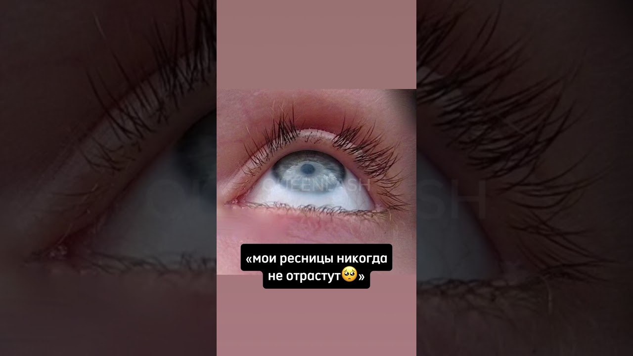 Артикул WILDBERRIES: 245492827, OZON: 1401498023 / сыворотка для роста ресниц QUEENLASH