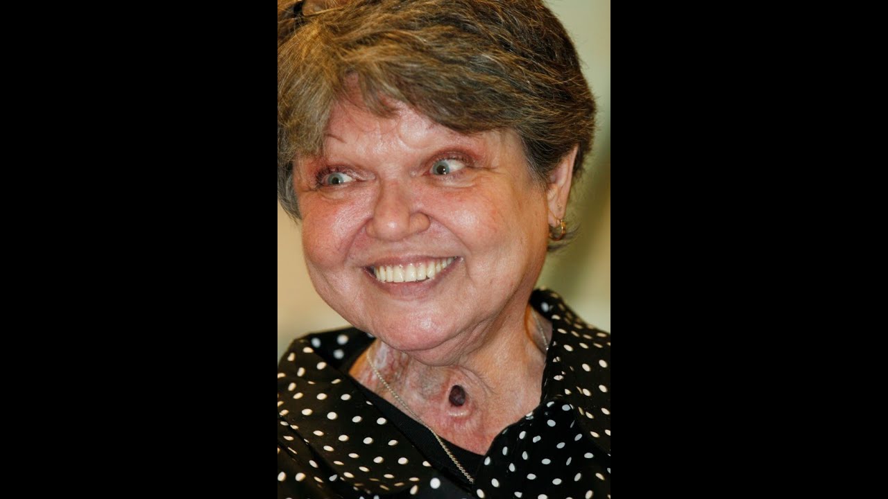 Hole In Throat Smoker Dead , Death sticks Claim another Life!!! YouTube