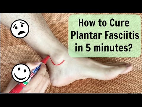any cure for plantar fasciitis