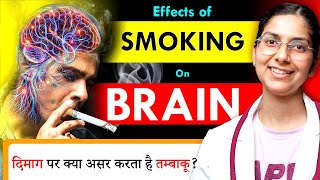 Effects of Smoking on the Brain Dr Richa Tiwari