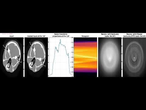 Computed Tomography |  Reconstruction | Back Projection | Filtered Back Projection | FFT | python