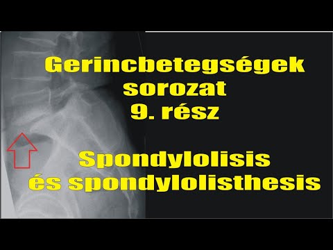 Videó: Mi az ADT az egészségügyben?