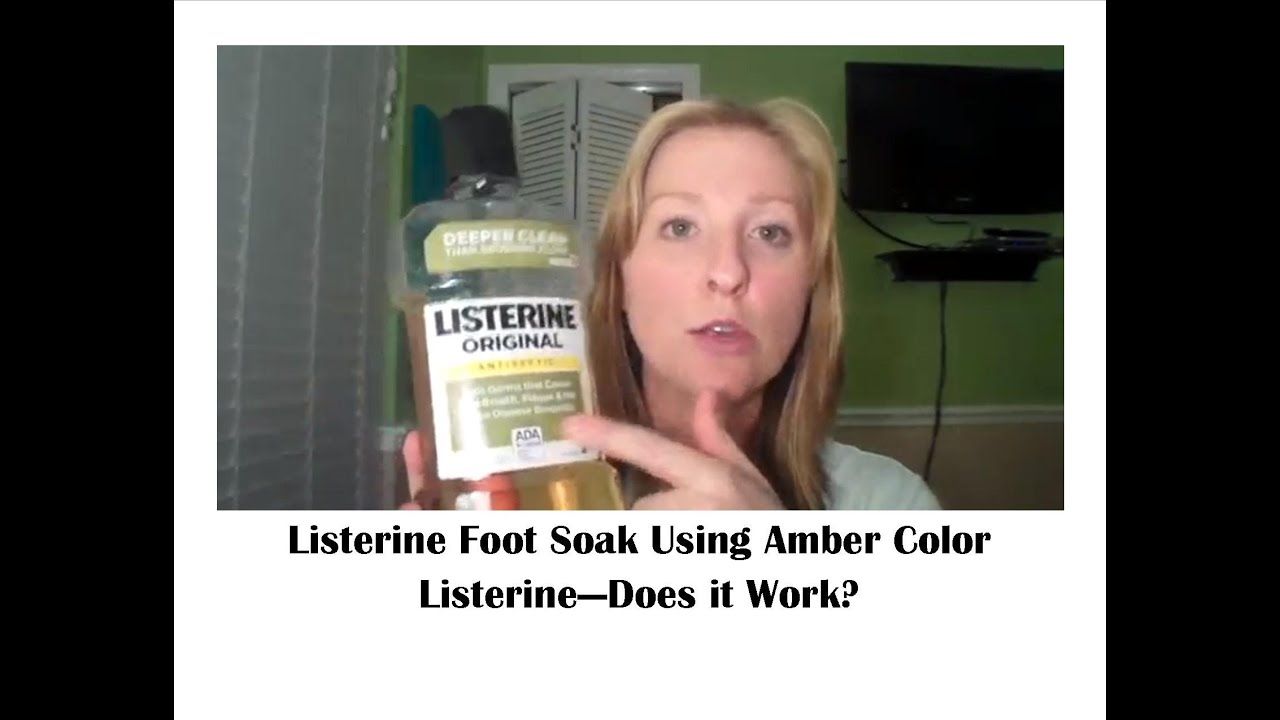 remedy for dry feet with listerine