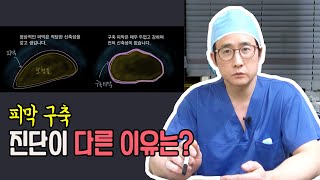[피막구축의 분류①] 의사들마다 구축 진단이 다른 이유는?